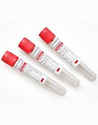 Lipase Pancreática imunorreativa felina (Spec - FLP)