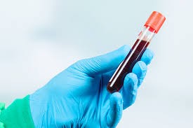 Cortisol (3 amostras) supressão dexametasona 