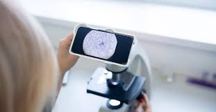 Babesia canis (PCR) Quantitativo 